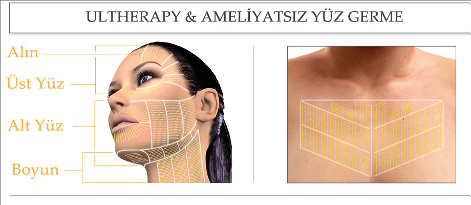 İstanbul Ultherapy Yüz Germe